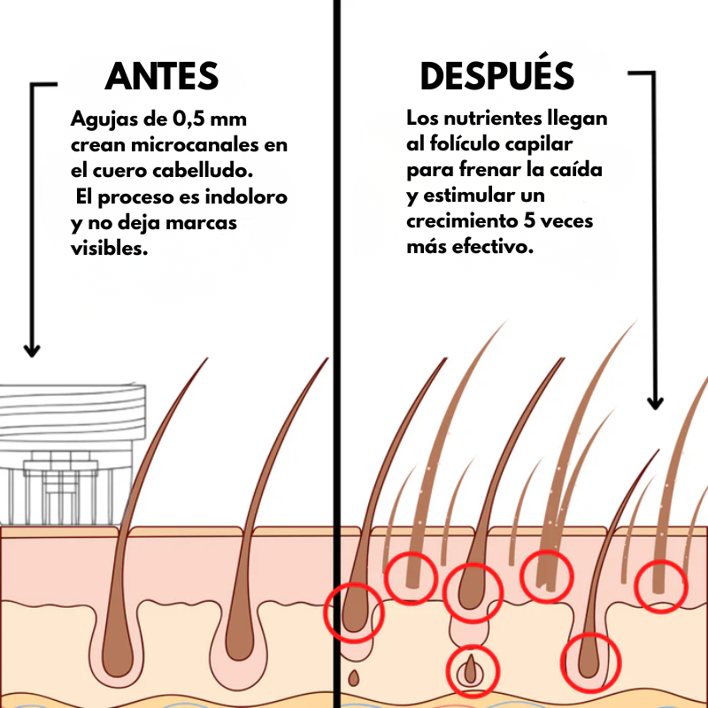 Soluciones Alpha - Sistema de Regeneración Capilar