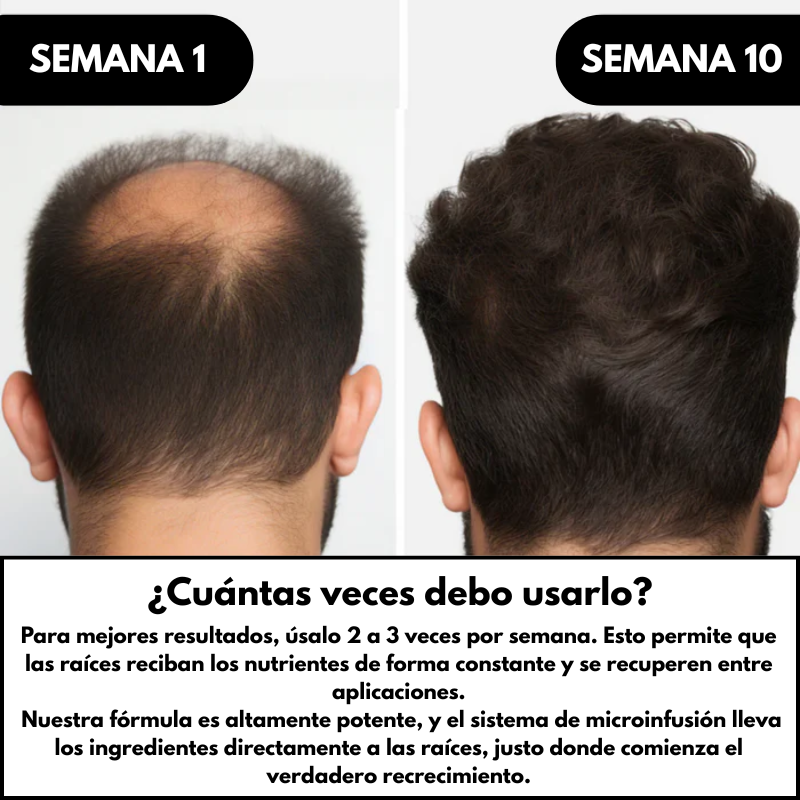 Soluciones Alpha - Sistema de Regeneración Capilar