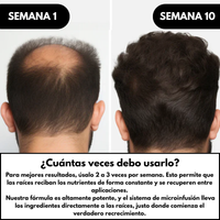 Soluciones Alpha - Sistema de Regeneración Capilar