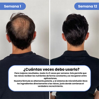 Sistema de Recuperación Capilar Avanzado